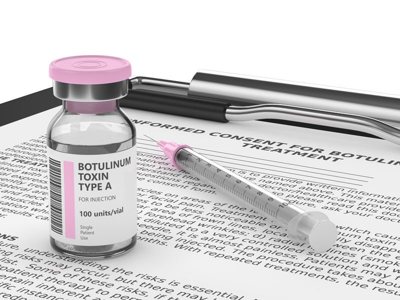 Tiêm BotulinumtoxinA (Botox) khi tiêm vào cơ gây liệt tạm thời các cơ co cứng, có tác dụng khoảng 3 tháng